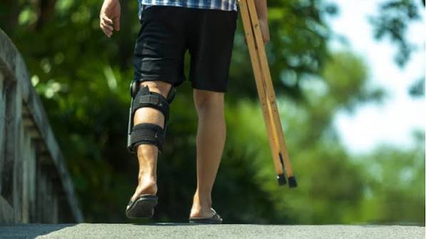 एसीएल (ACL) टियर सर्जरी के बाद स्पोर्ट्स में वापसी (Return to Sport) का प्रोटोकॉल