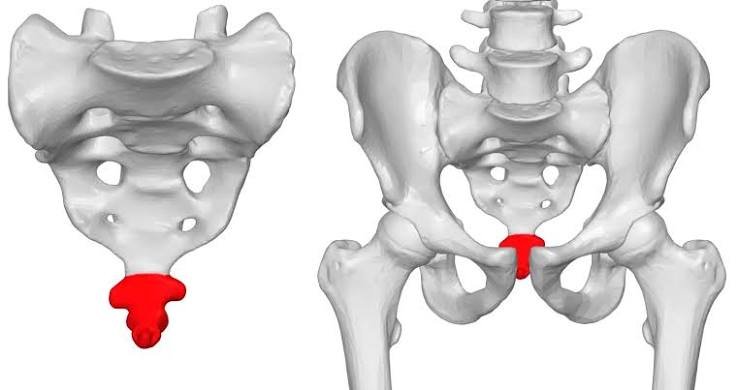 कॉक्सीडीनिया (Coccydynia / Tailbone Pain) के लिए सही कुशन और बैठने का तरीका