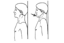 गर्दन के दर्द और सर्वाइकल के लिए चिन टक (Chin Tuck) एक्सरसाइज का वीडियो