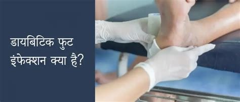 डायबिटिक फुट (Diabetic Foot) की देखभाल: सही कुशनिंग और मोजों का चुनाव