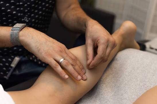 ड्राई नीडलिंग (Dry Needling) थेरेपी: ट्रिगर पॉइंट्स को खोलने की आधुनिक तकनीक