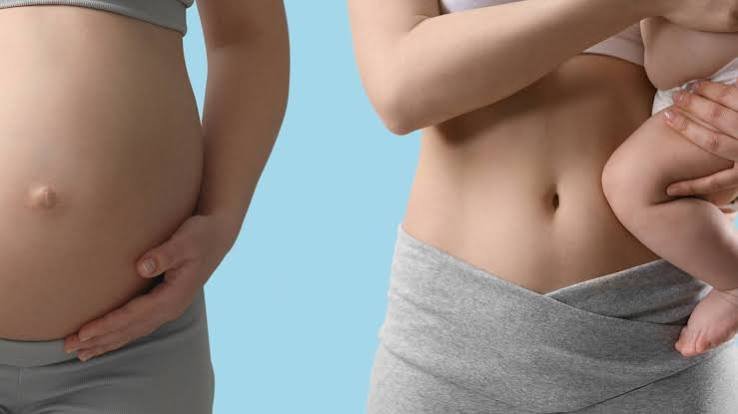 न्यू-मॉम्स (New Moms) के लिए पोस्ट-पार्टम (Post-partum) बेली फैट कम करने के तरीके