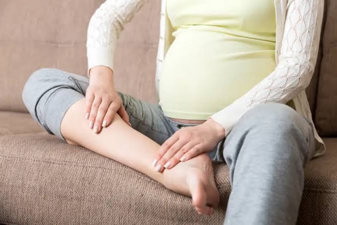प्रेगनेंसी में पैरों की सूजन (Edema) कम करने के प्राकृतिक और क्लिनिकल उपाय