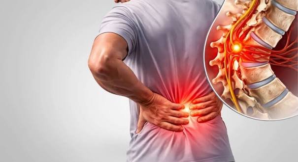 लाइव डेमो: स्लिप डिस्क के मरीजों के लिए सुरक्षित तरीके से झुकने और वजन उठाने का तरीका