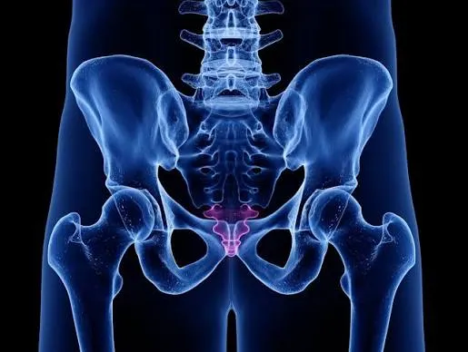 कॉक्सीडीनिया (Tailbone Pain) के लिए सही कुशन का चुनाव और क्लिनिकल थेरेपी