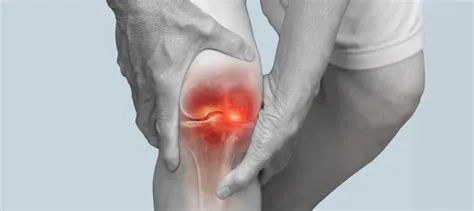 घुटने में पानी भरना (Knee Effusion): कारण, लक्षण और फिजियोथेरेपी प्रबंधन