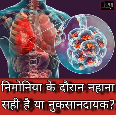 निमोनिया (Pneumonia)