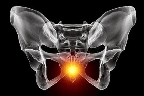 प्रेगनेंसी में टेलबोन पेन (Coccydynia) से राहत के लिए पेल्विक रॉकिंग एक्सरसाइज