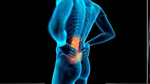 रीढ़ की हड्डी में लम्बर लॉर्डोसिस (Hyperlordosis) को ठीक करने के पेल्विक टिल्ट व्यायाम