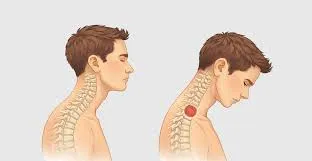 सर्वाइकल आइसोमेट्रिक्स (Cervical Isometrics): बिना गर्दन हिलाए मांसपेशियां मजबूत करना