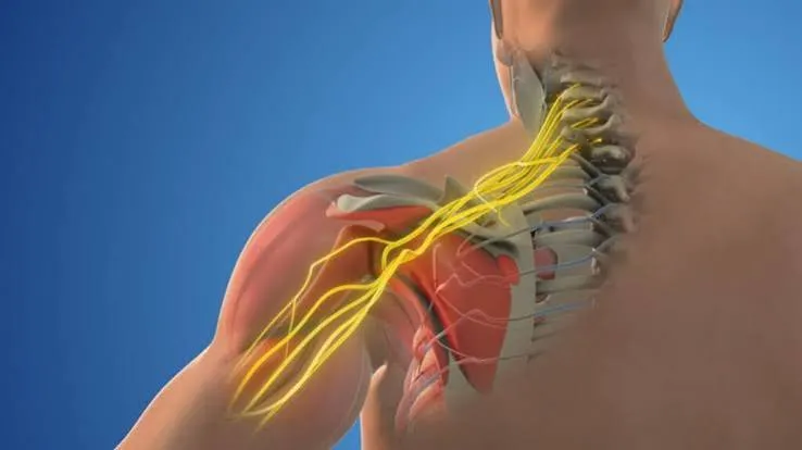 सर्वाइकल स्पाइन में नसों का दबाव (Nerve Compression): शुरुआती संकेत और सुरक्षित व्यायाम