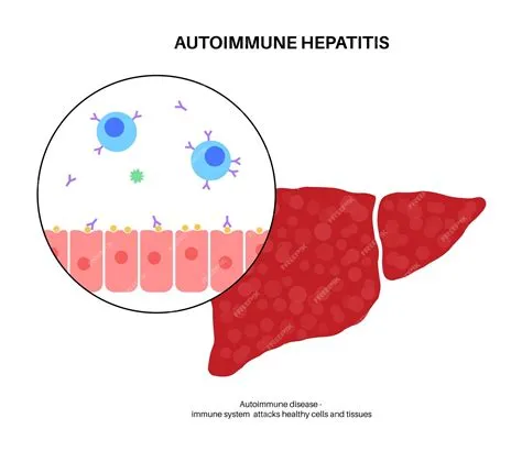 ऑटोइम्यून हेपेटाइटिस (Autoimmune Hepatitis)