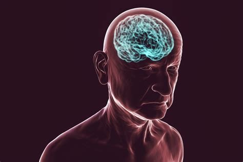 डिमेंशिया (Dementia / भूलने की बीमारी)
