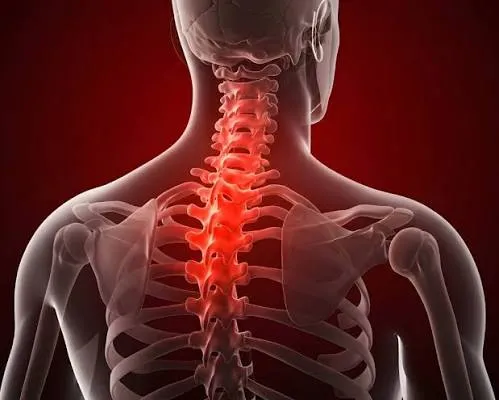 थोरैसिक आउटलेट सिंड्रोम (TOS) के कारण हाथों में आने वाले सुन्नपन का इलाज