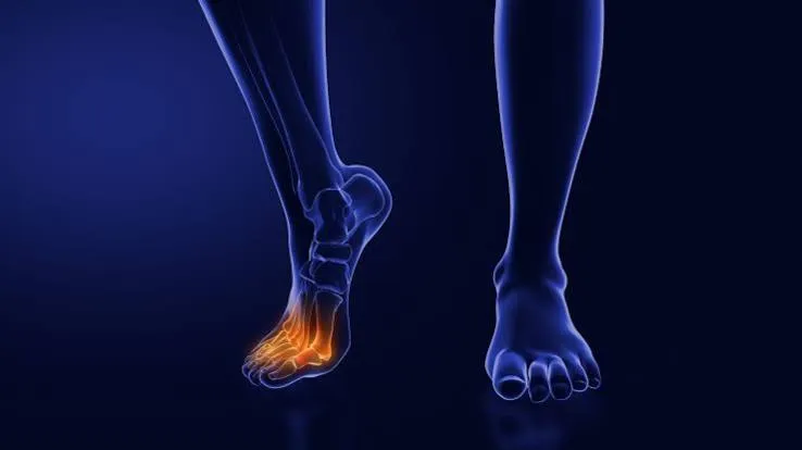 न्यूरोपैथी (Neuropathy) में पैरों के सुन्नपन और झनझनाहट का फिजियोथेरेपी इलाज