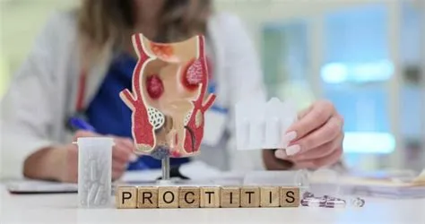 प्रोक्टाइटिस (Proctitis - मलाशय की सूजन)