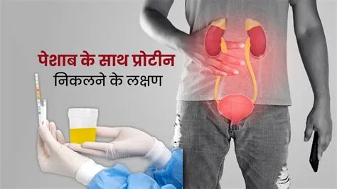 प्रोटीन्यूरिया (Proteinuria - पेशाब में प्रोटीन आना)