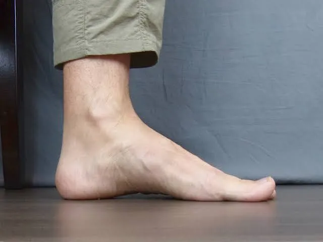 फ्लैट फुट (Flat Feet) को प्राकृतिक रूप से सुधारने के लिए वृक्षासन (Tree Pose)