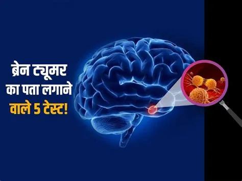 ब्रेन ट्यूमर (Brain Tumor)
