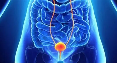 ब्लैडर कैंसर (Bladder Cancer)