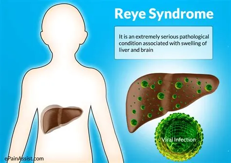 रेये सिंड्रोम (Reye's Syndrome)