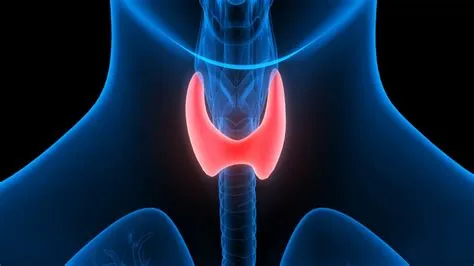 हाइपरथायरायडिज्म (Hyperthyroidism - ओवरएक्टिव थायराइड)
