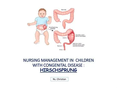 हिर्शस्प्रंग रोग (Hirschsprung Disease - आंतों का रोग)