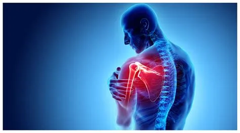क्रोनिक रीजनल पेन सिंड्रोम (CRPS - चोट के बाद गंभीर और पुराना दर्द)