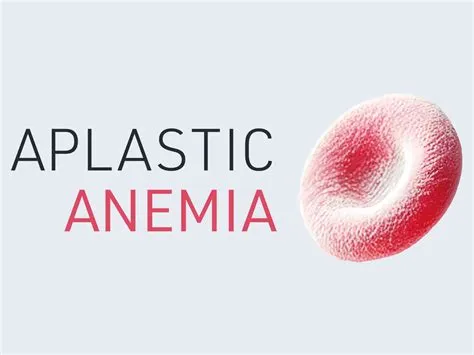 अप्लास्टिक एनीमिया (Aplastic Anemia - बोन मैरो का खून न बनाना)