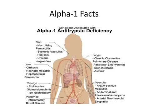 अल्फा-1 एंटीट्रिप्सिन की कमी (Alpha-1 Antitrypsin Deficiency)