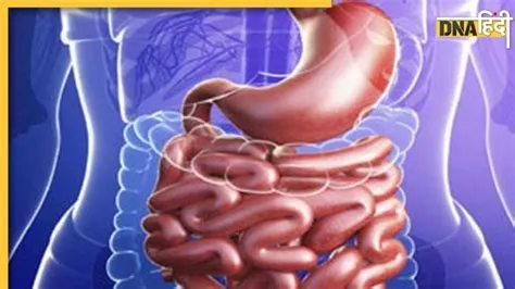 इंट्यूससेप्शन (Intussusception - आंत का अपने ही अंदर धंस जाना)