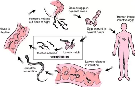 एंटरोबियासिस (Enterobiasis - पिनवर्म / थ्रेडवर्म बच्चों में मलद्वार की खुजली)
