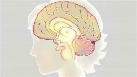 एक्रोमेगाली (Acromegaly - वृद्धि हार्मोन की अधिकता)