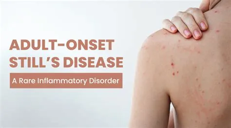 एडल्ट-ऑनसेट स्टिल्स डिजीज (Adult-Onset Still's Disease)