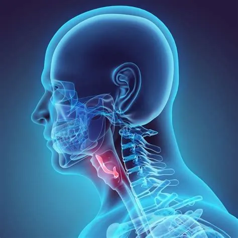एपिग्लोटाइटिस (Epiglottitis - श्वासनली के ढक्कन की सूजन, जो जानलेवा हो सकती है)
