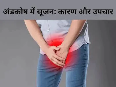 एपिडीडिमाइटिस (Epididymitis - अंडकोष की नली में सूजन और संक्रमण)