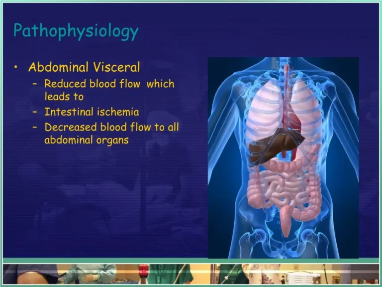एब्डोमिनल कम्पार्टमेंट सिंड्रोम (Abdominal Compartment Syndrome - पेट में जानलेवा दबाव)