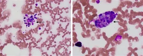 एर्लिचियोसिस (Ehrlichiosis)