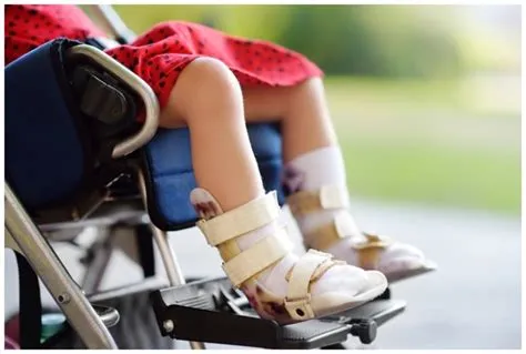 ऑस्टियोजेनेसिस इम्परफेक्टा (Osteogenesis Imperfecta - ब्रिटल बोन डिजीज)