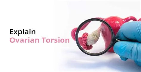 ओवेरियन टॉर्शन (Ovarian Torsion - अंडाशय का मुड़ना)