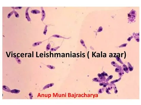 काला अजार (Kala-azar / Visceral Leishmaniasis)