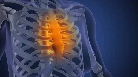 कॉस्टोकॉन्ड्राइटिस (Costochondritis - छाती की हड्डियों में दर्द)