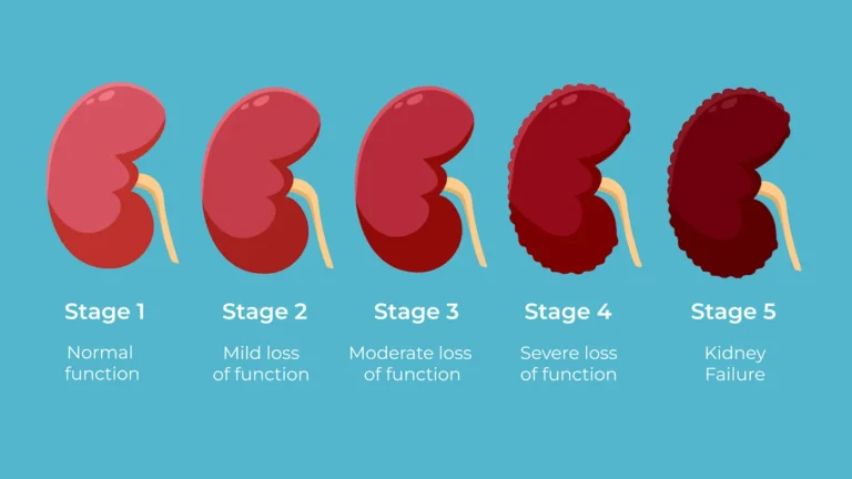 क्रॉनिक रीनल फेल्योर (Chronic Renal Failure)
