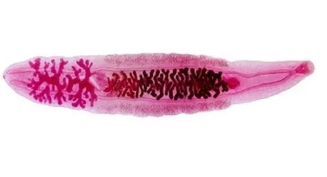 क्लोनोर्चियासिस (Clonorchiasis - चाइनीज लिवर फ्लूक संक्रमण)