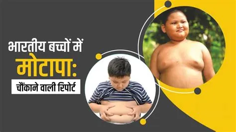 गिगेंटिज्म (Gigantism - बच्चों में अत्यधिक शारीरिक वृद्धि)