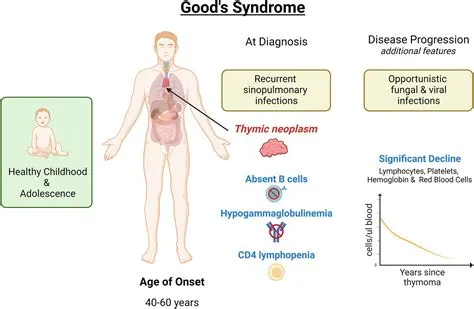 गुड सिंड्रोम (Good Syndrome)