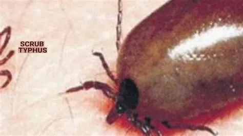 टायफस (Typhus Fever)