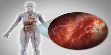 टेपवर्म संक्रमण (Tapeworm Infection - फीताकृमि)