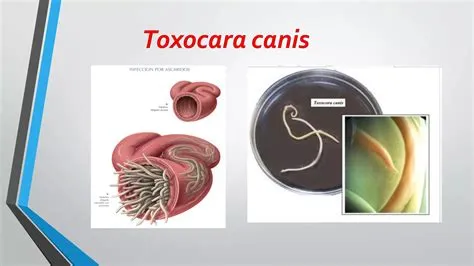 टॉक्सोकेरिएसिस (Toxocariasis)