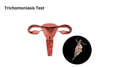 ट्राइकोमोनिएसिस (Trichomoniasis - यौन संचारित संक्रमण)